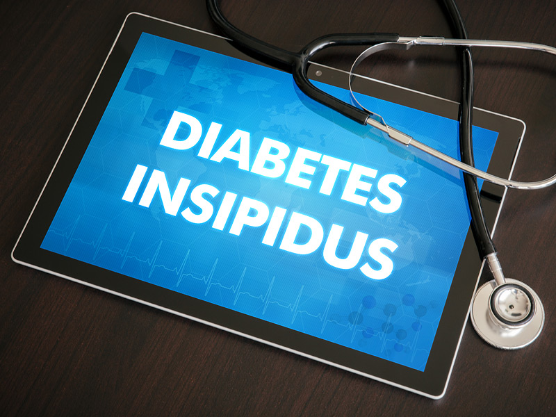 Diabetes Insipidus in children