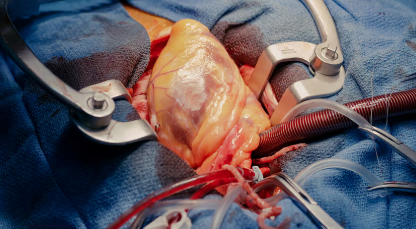 Актуальні питання кардіохірургії